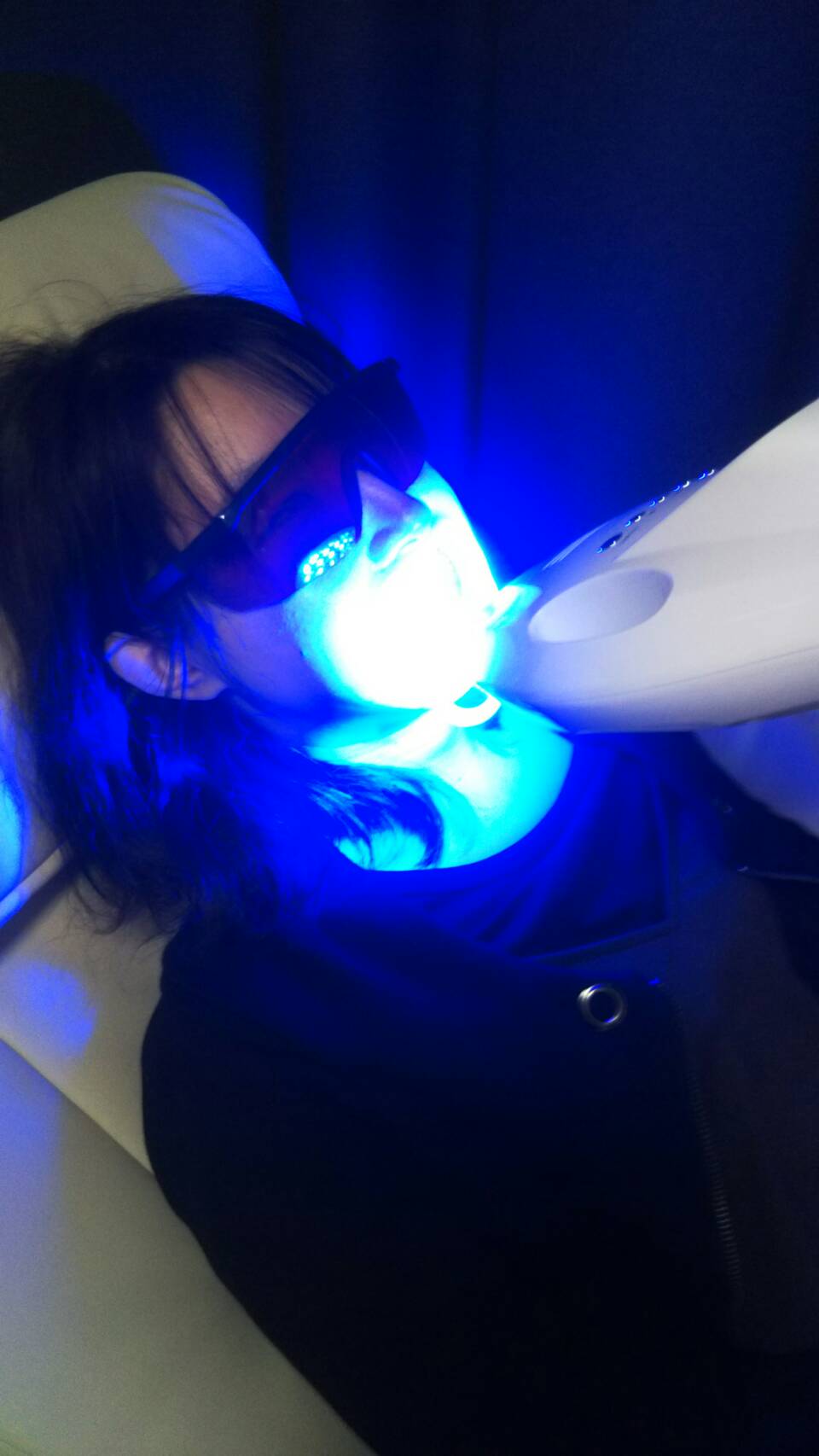 セルフホワイトニング施術風景